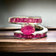Ruby with Bands